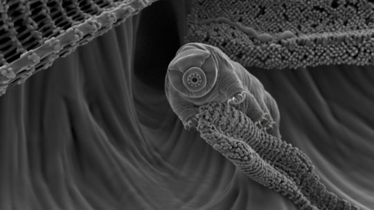 Les 10 micro-organismes les plus terrifiants sous le microscope!